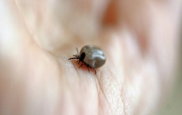 La maladie la plus fréquente transmise par une morsure de tique est la maladie de Lyme.